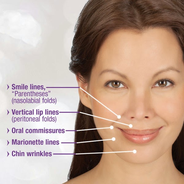 Juvederm® Ultra Use Locations for Phoenix Anti-Aging Beauty