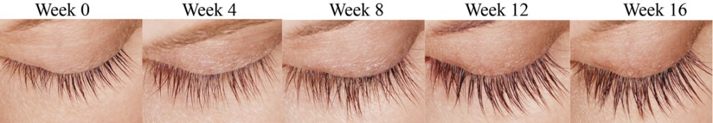 Phoenix Latisse Eyelash Treatment with Dr. Nello Rossi in Arizona